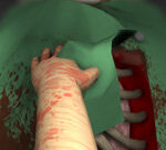 Surgeon Simulator 2013